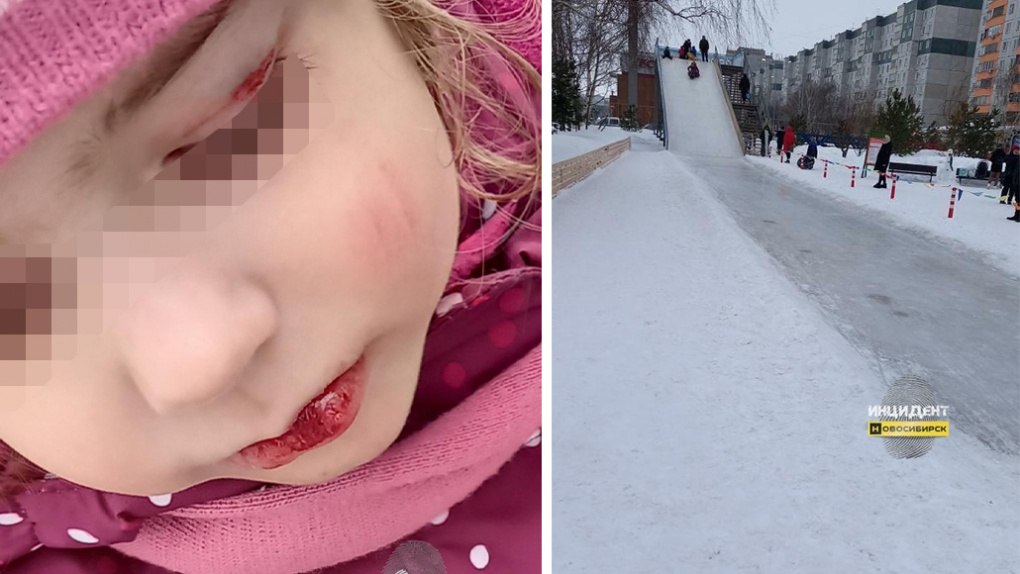 Окровавленное лицо: администрация новосибирского ТЦ обвиняет мать в травмировании дочери на горке